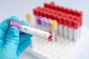 Топ-5 преимуществ каннабиса при ВИЧ/СПИД-е